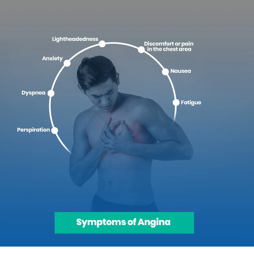 Angina, source: www.fatiguetalk.com 